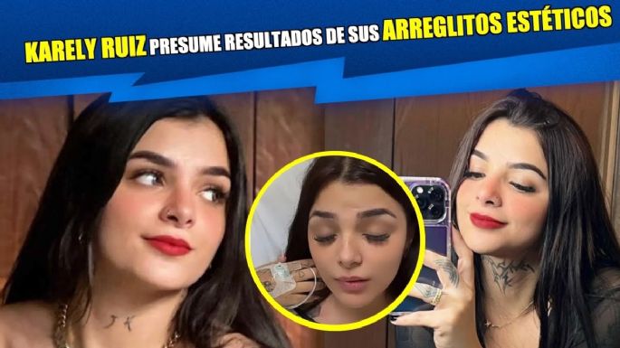Karely Ruiz presumió la más reciente cirugía estética a la que se sometió