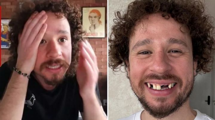 Luisito Comunica revela lo que pasó con sus dientes ¿Nos engañó a todos?