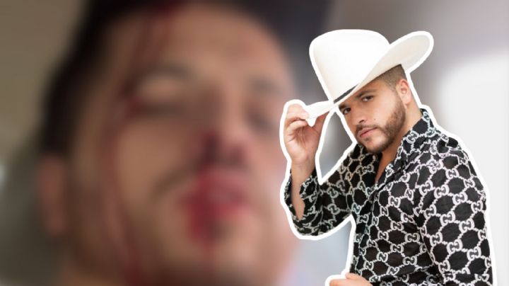 Jesús Mendoza 'El Rayo de Oro' sufre aparatoso accidente: VIDEO