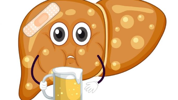 ¿Qué pasa cuando se tiene hígado graso? Estos son los síntomas, causas y consecuencias