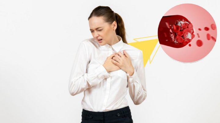 ¿Qué es una trombosis y cómo se puede detectar? Estos son sus tipos y síntomas