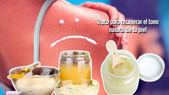 Este es el secreto para recupera tu tono de piel después de ir a la playa