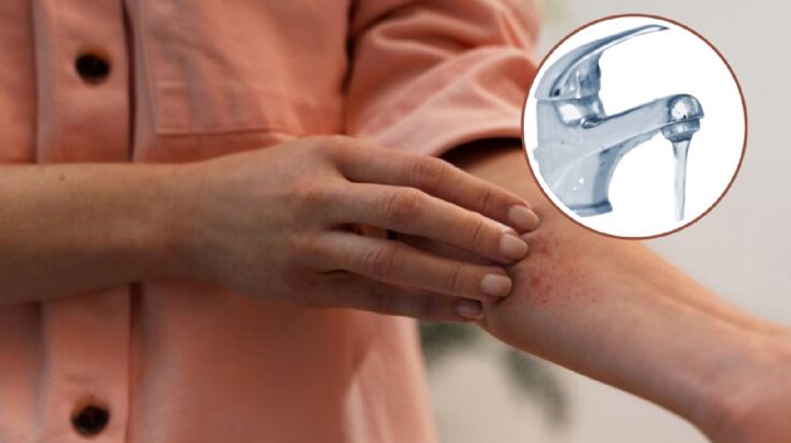 Agua contaminada en CDMX: Estos son los daños reportados por su consumo