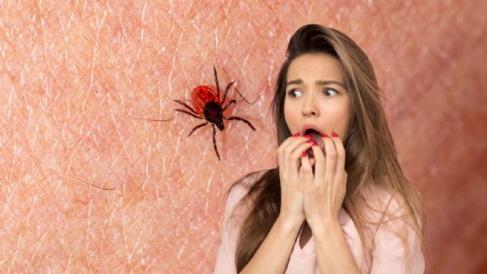 Así puedes eliminar las garrapatas de la piel en tu cuerpo