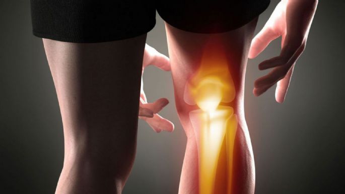 Estrés laboral puede provocar “Dolor de rodilla”: Así afecta las articulaciones, según expertos
