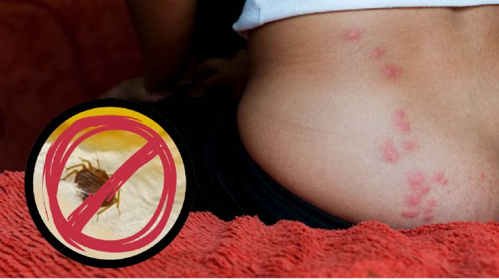 Esto es lo que puedes usar para evitar las picaduras de chinches
