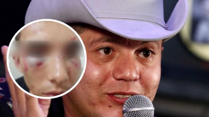 Remmy Valenzuela casi pierde su carrera y éxitos por una disputa familiar ¿Qué sucedió?