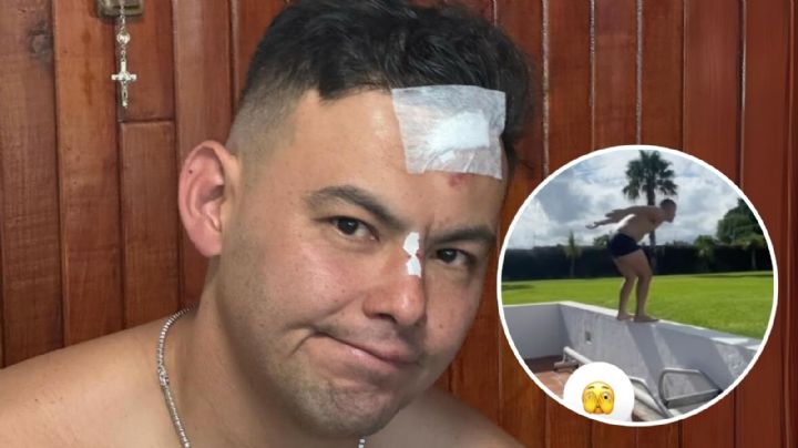 El Yaki es hospitalizado tras sufrir fuerte accidente en la cabeza: ¿Qué le pasó? VIDEO