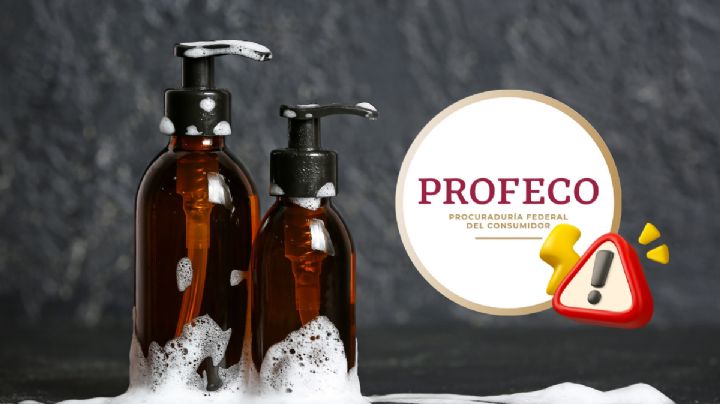 ¡Cuidado con estos shampoos! Profeco alerta sobre su uso por alergia, irritación y caída de cabello