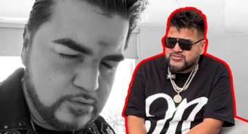 El Mimoso preocupa a sus fans tras publicar FOTO con heridas en el rostro, ¿Qué pasó?