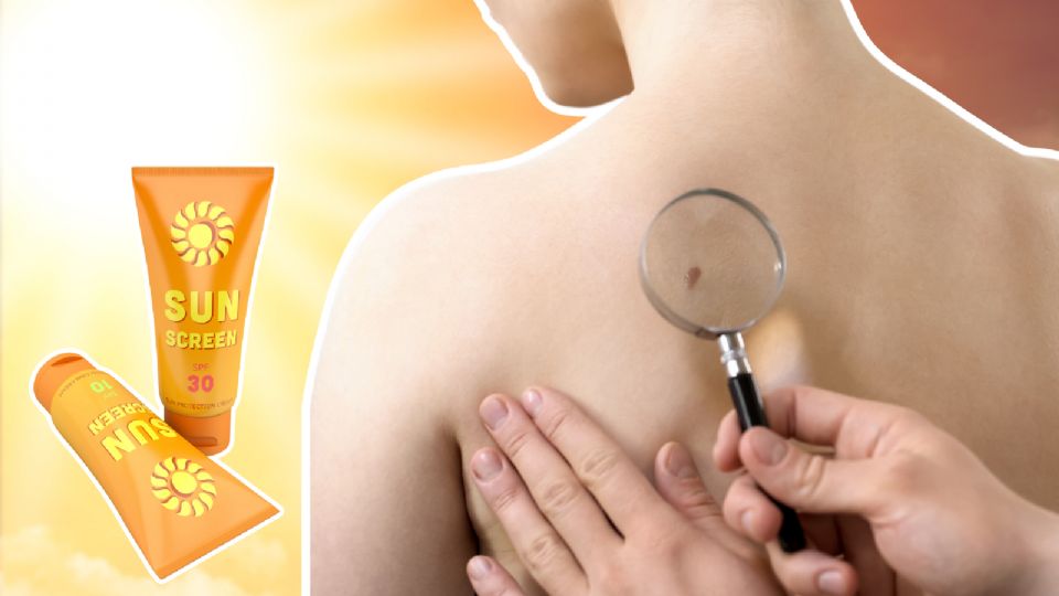 Estas son las mejores marcas de protector solar para combatir el cáncer de piel