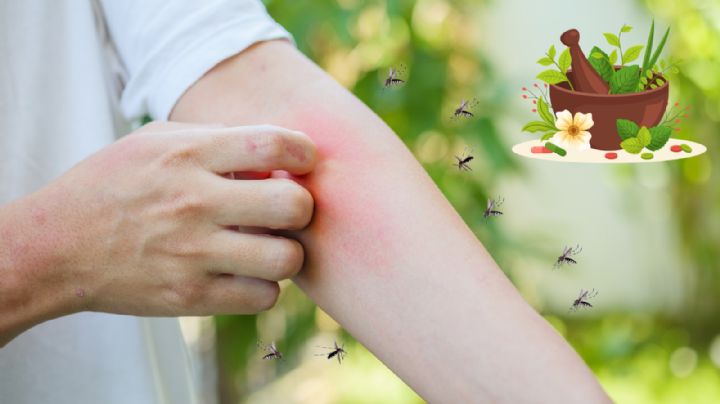 Los mejores remedios para aliviar comezón y ronchas de mosquitos