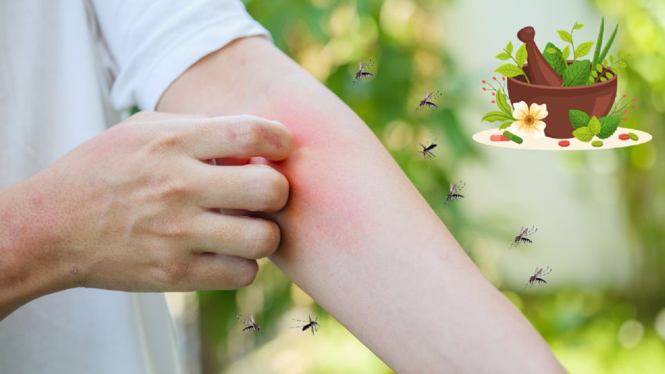 Estos son los mejores remedios para aliviar las molestias por las picaduras de moscos.