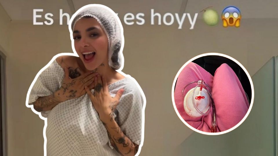 Karely Ruiz se somete a nueva cirugía estética